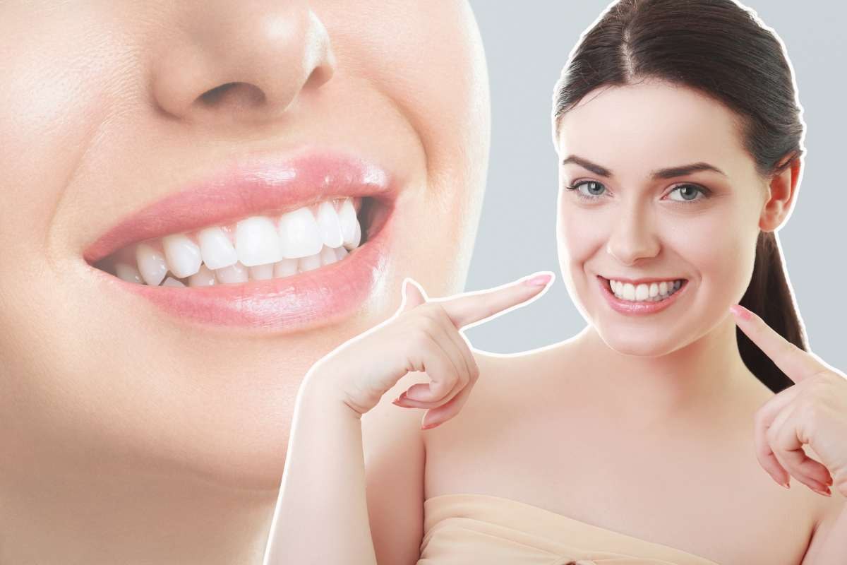 collage volto di donna che sorride e ragazza che indica i denti
